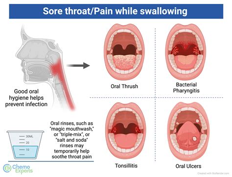 Can You Get A Sore Throat From Oral